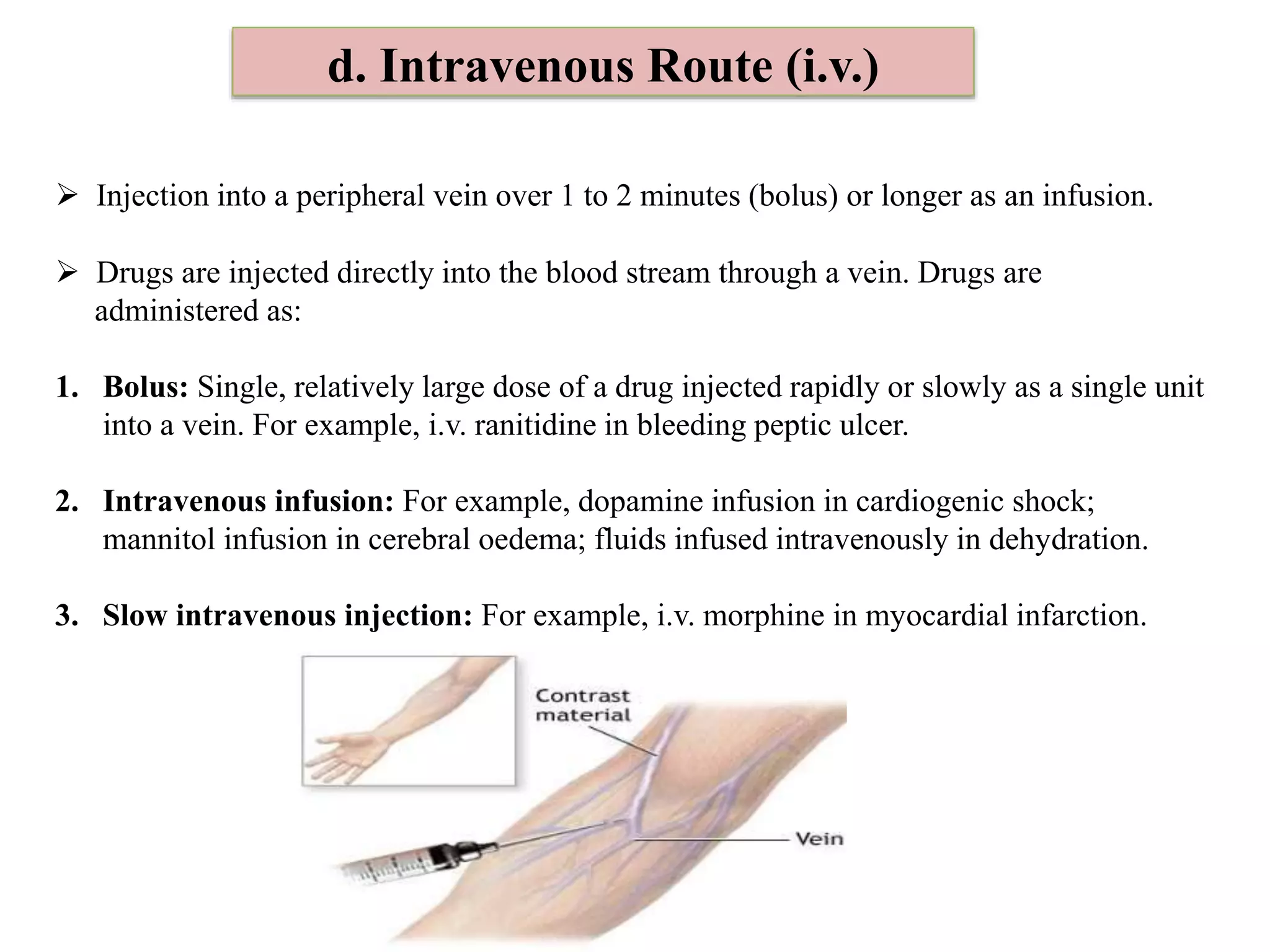 d. Intravenous Route (i.v.)
 Injection into a peripheral vein over 1 to 2 minutes (bolus) or longer as an infusion.
 Drugs are injected directly into the blood stream through a vein. Drugs are
administered as:
1. Bolus: Single, relatively large dose of a drug injected rapidly or slowly as a single unit
into a vein. For example, i.v. ranitidine in bleeding peptic ulcer.
2. Intravenous infusion: For example, dopamine infusion in cardiogenic shock;
mannitol infusion in cerebral oedema; fluids infused intravenously in dehydration.
3. Slow intravenous injection: For example, i.v. morphine in myocardial infarction.
 