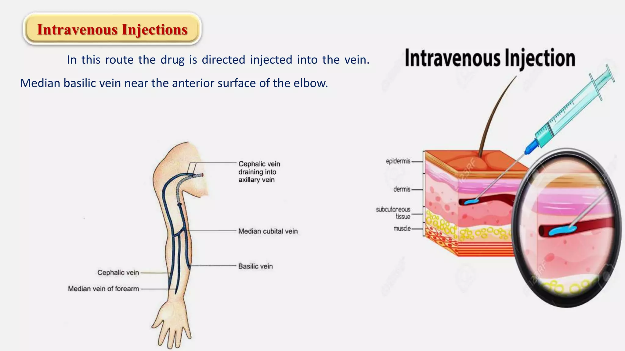 Intravenous Injections
In this route the drug is directed injected into the vein.
Median basilic vein near the anterior surface of the elbow.
 