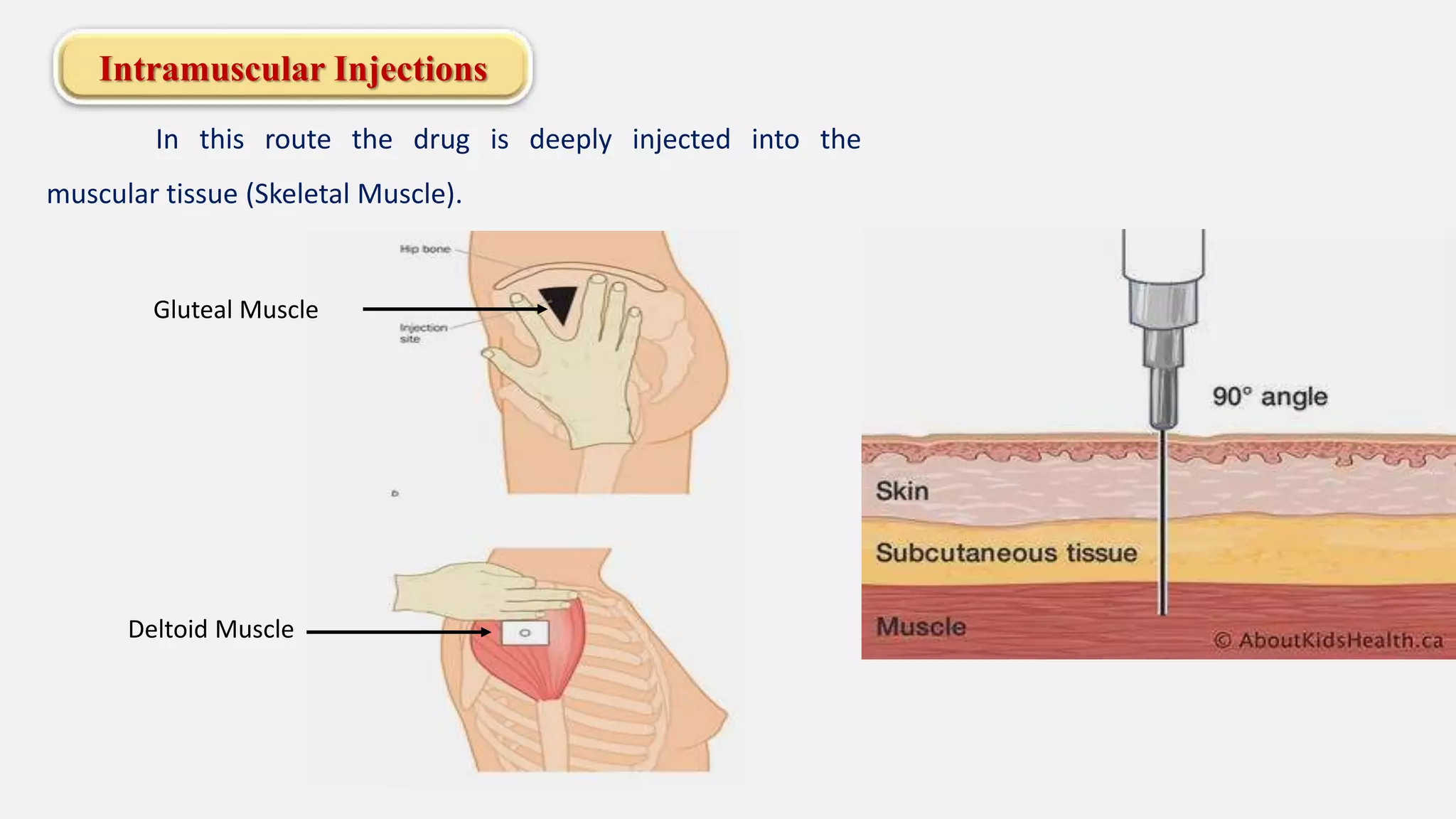 Intramuscular Injections
In this route the drug is deeply injected into the
muscular tissue (Skeletal Muscle).
Gluteal Muscle
Deltoid Muscle
 