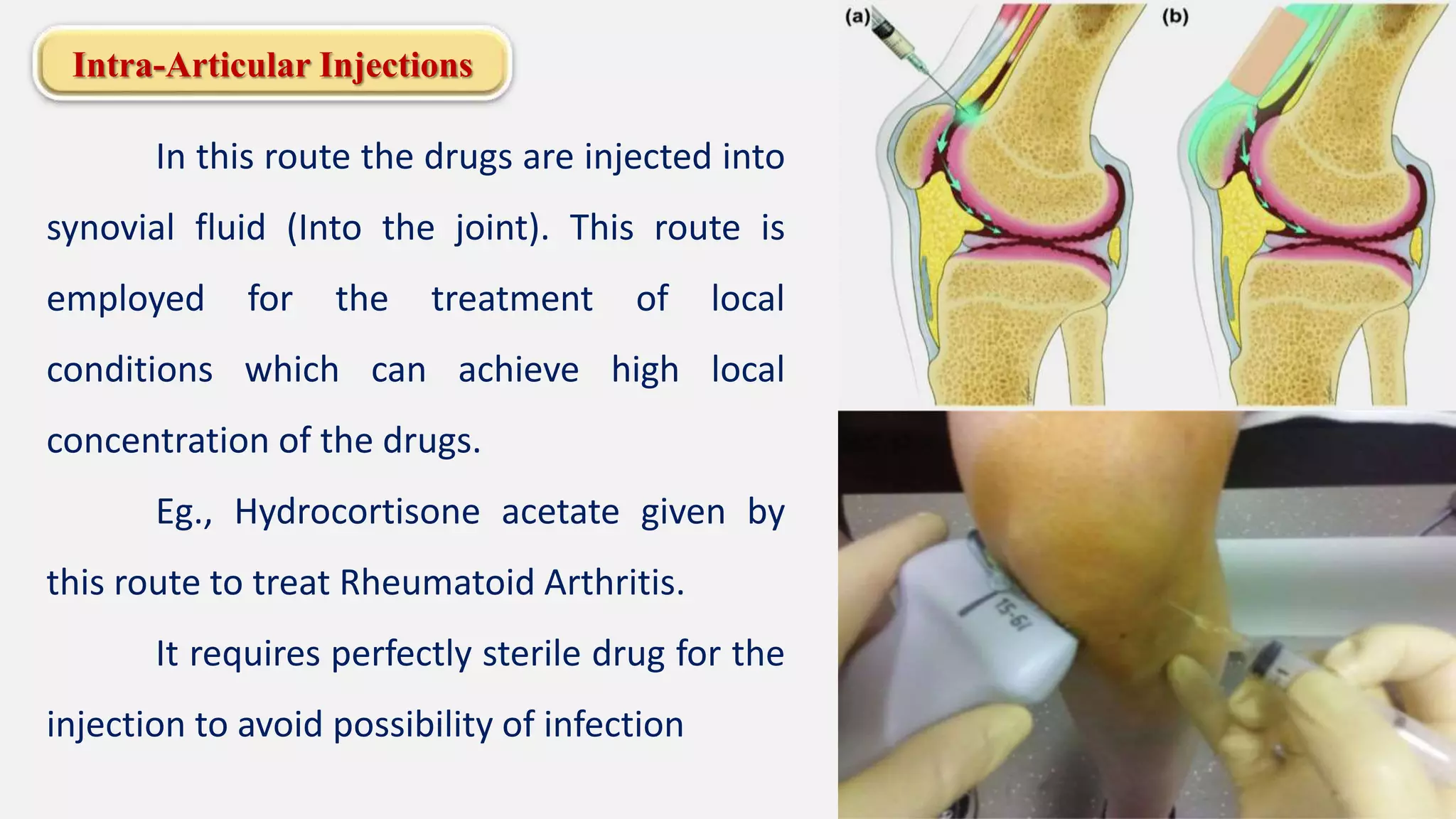 Intra-Articular Injections
In this route the drugs are injected into
synovial fluid (Into the joint). This route is
employed for the treatment of local
conditions which can achieve high local
concentration of the drugs.
Eg., Hydrocortisone acetate given by
this route to treat Rheumatoid Arthritis.
It requires perfectly sterile drug for the
injection to avoid possibility of infection
 