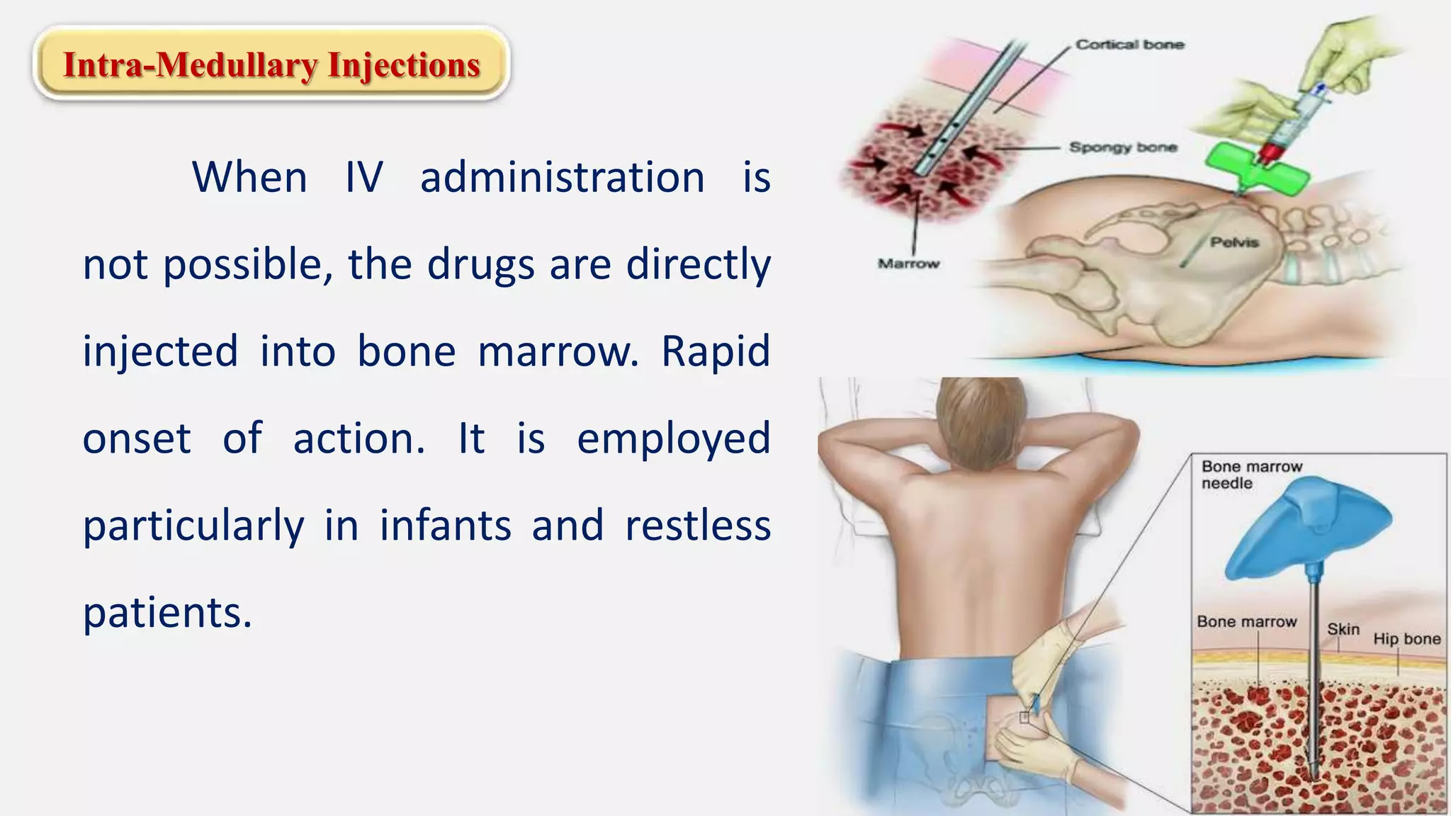 Intra-Medullary Injections
When IV administration is
not possible, the drugs are directly
injected into bone marrow. Rapid
onset of action. It is employed
particularly in infants and restless
patients.
 