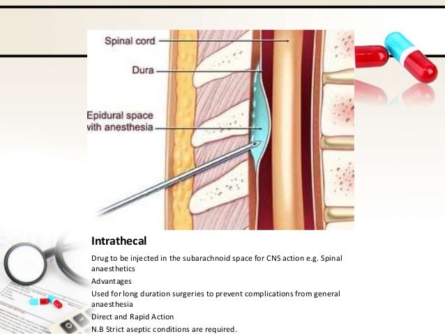 Routes of drug administration