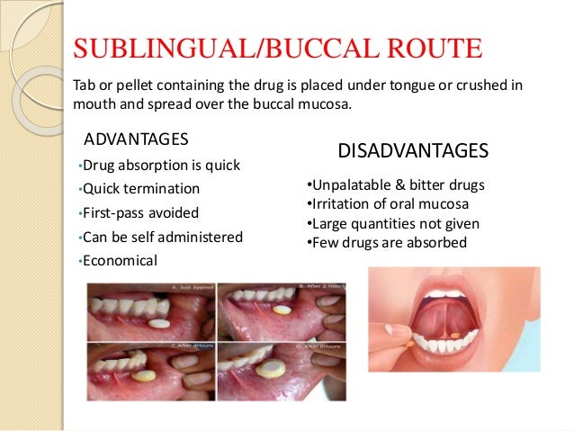 How Does A Sublingual Medication Get Absorbed Into The Bloodstream Routes of drug administration