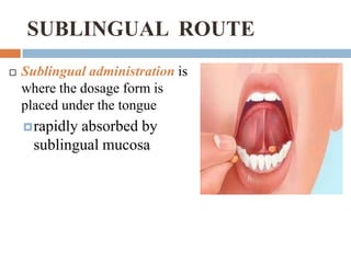 SUBLINGUAL ROUTE
12

 ADVANTAGES
        ECONOMICAL
        QUICK TERMINATION
        FIRST-PASS AVOIDED
        DRUG ...
