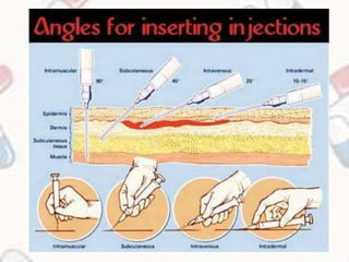 Minor Injection Routes Pharmacology Routes of drug administration seminar | PPTX