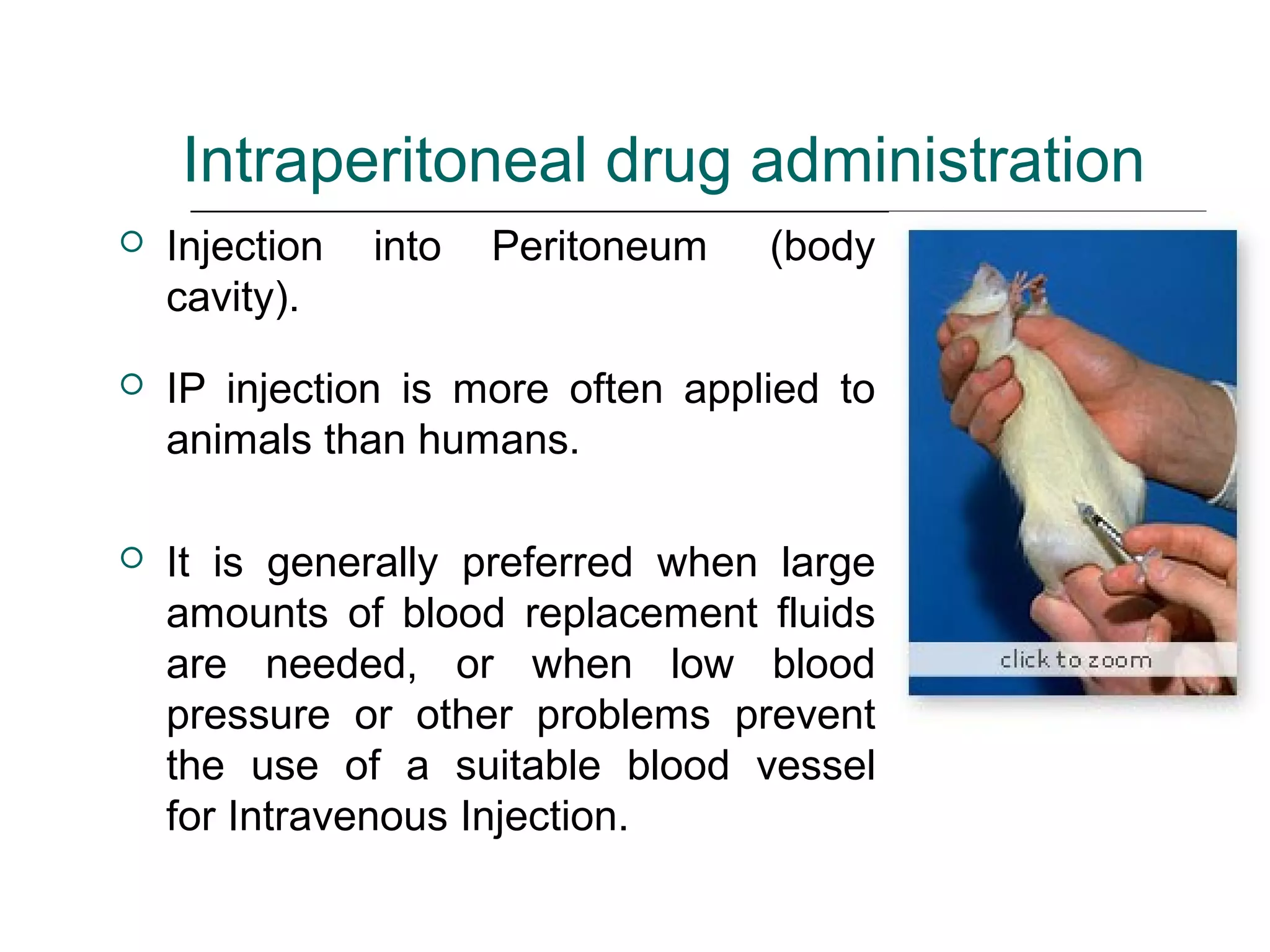 Routes of drug s administration | PPT