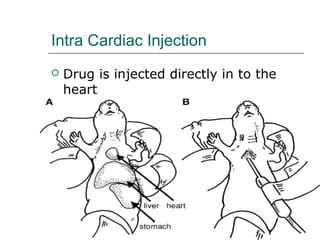 Routes of drug s administration | PPT