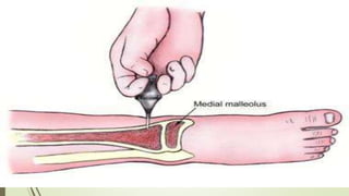 Medial Injection Routes of medication administration | PPTX