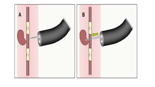ROUTINE BRONCHOSCOPIC SAMPLING TECHNIQUES -part 2.pptx
