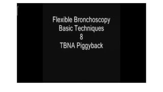ROUTINE BRONCHOSCOPIC SAMPLING TECHNIQUES -part 2.pptx