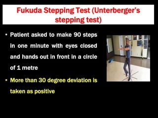 Fukuda Stepping Test (Unterberger’s
stepping test)
• Patient asked to make 90 steps
in one minute with eyes closed
and hands out in front in a circle
of 1 metre
• More than 30 degree deviation is
taken as positive
 