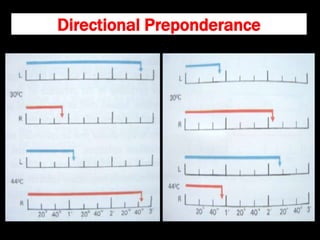 Directional Preponderance
 