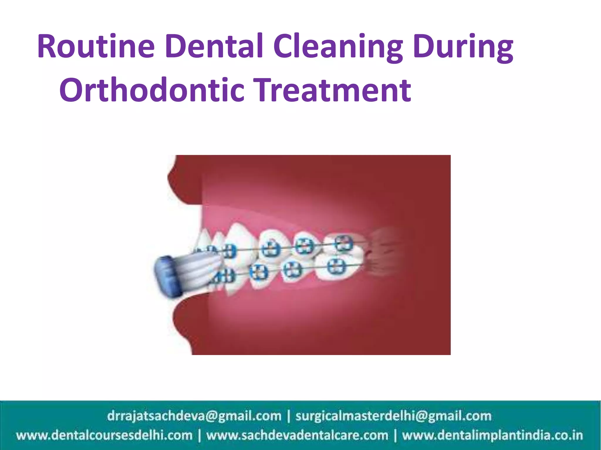 Routine dental cleaning during orthodontic treatment oral hygiene