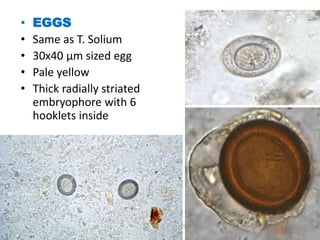 • EGGS
• Same as T. Solium
• 30x40 µm sized egg
• Pale yellow
• Thick radially striated
embryophore with 6
hooklets inside
Stool examination by Dr. Priyanka
Buragohain
107
 