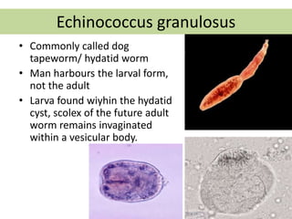 Echinococcus granulosus
• Commonly called dog
tapeworm/ hydatid worm
• Man harbours the larval form,
not the adult
• Larva found wiyhin the hydatid
cyst, scolex of the future adult
worm remains invaginated
within a vesicular body.
Stool examination by Dr. Priyanka
Buragohain
108
 