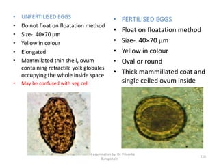 • UNFERTILISED EGGS
• Do not float on floatation method
• Size- 40×70 µm
• Yellow in colour
• Elongated
• Mammilated thin shell, ovum
containing refractile yolk globules
occupying the whole inside space
• May be confused with veg cell
• FERTILISED EGGS
• Float on floatation method
• Size- 40×70 µm
• Yellow in colour
• Oval or round
• Thick mammillated coat and
single celled ovum inside
Stool examination by Dr. Priyanka
Buragohain
116
 