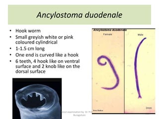 Ancylostoma duodenale
• Hook worm
• Small greyish white or pink
coloured cylindrical
• 1-1.5 cm long
• One end is curved like a hook
• 6 teeth, 4 hook like on ventral
surface and 2 knob like on the
dorsal surface
Stool examination by Dr. Priyanka
Buragohain
119
 