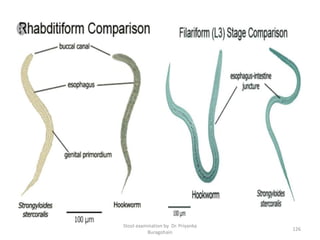 Stool examination by Dr. Priyanka
Buragohain
126
 