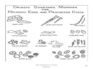 Stool examination by Dr. Priyanka
Buragohain
129
 