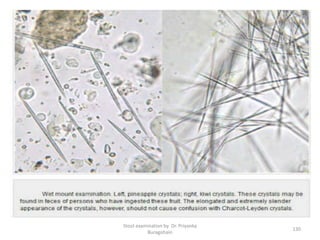 Stool examination by Dr. Priyanka
Buragohain
130
 