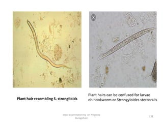 Stool examination by Dr. Priyanka
Buragohain
131
Plant hairs can be confused for larvae
oh hookworm or Strongyloides stercoralisPlant hair resembling S. strongiloids
 