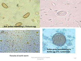 Stool examination by Dr. Priyanka
Buragohain
132
Parasite of earth worm
Pollen grain resemblening to
fertile egg of A. lumbricoids
Bee pollen resembling t. Trichuria egg
 