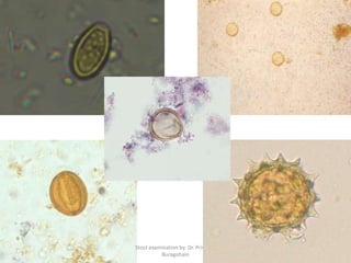 Stool examination by Dr. Priyanka
Buragohain
133
 