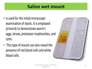 Saline wet mount
Stool examination by Dr. Priyanka
Buragohain
51
 