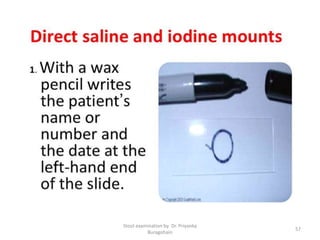 Stool examination by Dr. Priyanka
Buragohain
57
 