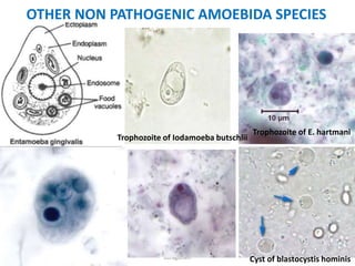 Stool examination by Dr. Priyanka
Buragohain
95
OTHER NON PATHOGENIC AMOEBIDA SPECIES
Trophozoite of E. hartmani
Trophozoite of Iodamoeba butschlii
Cyst of blastocystis hominis
 