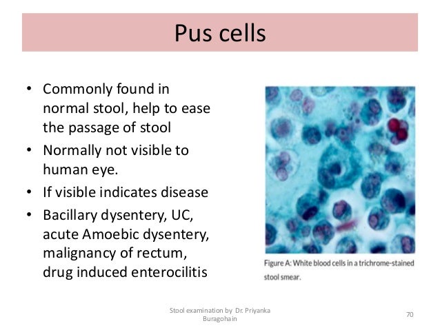 Epithelial Cells In Stool Normal Range
