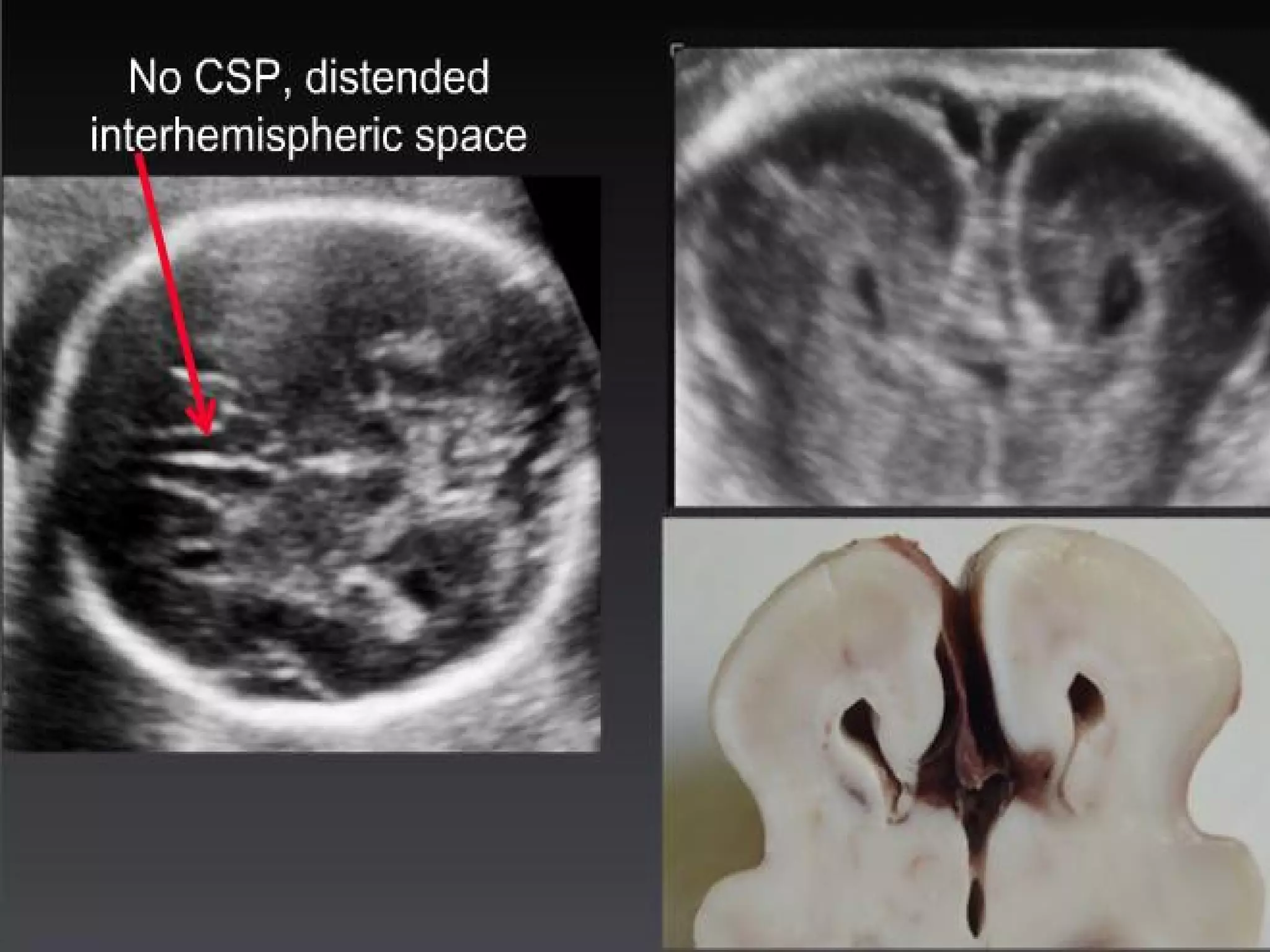 Routine fetal anatomy scan at 18-23 weeks | PPT