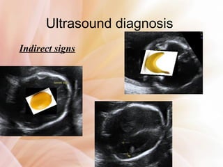Routine fetal anatomy scan at 18-23 weeks | PPT