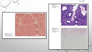 Routine histopathology techniques and staining [Autosaved].pptx