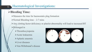 Haematological Investigations:
Bleeding Time:
Measures the time for haemostatic plug formation
Normal Bleeding time – 2-7 mins
Any clotting factor deficiency or platelet abnormality will lead to increased BT
Prolonged in
Thrombocytopenia
Acute leukaemia
Aplastic anaemia
Liver diseases
Von-Willebrand’s disease
31
 