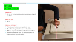 ROUTINE PROJECTIONS FOR FINGERS ppt.pptx