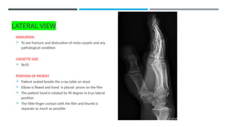 ROUTINE PROJECTIONS FOR HAND............ | PPTX