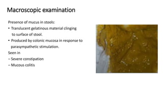 Macroscopic examination
Presence of mucus in stools:
• Translucent gelatinous material clinging
to surface of stool.
• Produced by colonic mucosa in response to
parasympathetic stimulation.
Seen in
– Severe constipation
– Mucous colitis
 
