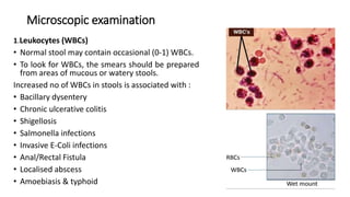 Microscopic examination
1.Leukocytes (WBCs)
• Normal stool may contain occasional (0-1) WBCs.
• To look for WBCs, the smears should be prepared
from areas of mucous or watery stools.
Increased no of WBCs in stools is associated with :
• Bacillary dysentery
• Chronic ulcerative colitis
• Shigellosis
• Salmonella infections
• Invasive E-Coli infections
• Anal/Rectal Fistula
• Localised abscess
• Amoebiasis & typhoid
 