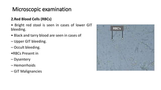Microscopic examination
2.Red Blood Cells (RBCs)
• Bright red stool is seen in cases of lower GIT
bleeding.
• Black and tarry blood are seen in cases of
– Upper GIT bleeding.
– Occult bleeding.
•RBCs Present in
– Dysentery
– Hemorrhoids
– GIT Malignancies
 