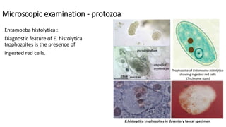 Microscopic examination - protozoa
Entamoeba histolytica :
Diagnostic feature of E. histolytica
trophozoites is the presence of
ingested red cells.
E.histolytica trophozoites in dysentery faecal specimen
 