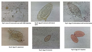 Fig 9. Larva of S.stercoralis seen with 100X objective Fig 10. Egg of S.mansoni with lateral
spine
Fig 11. Egg of S.intercalatum with terminal spines
Fig 12. Egg of S. japonicum
Fig 13. Egg of O.sinensis Fig 14. Eggs of F. hepatica
 
