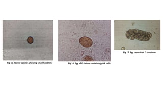 Fig 15. Taenia species showing small hooklets Fig 16. Egg of D. latum containing yolk cells
Fig 17. Egg capsule of D. caninum
 