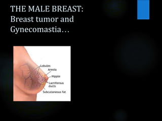 THE MALE BREAST:
Breast tumor and
Gynecomastia…
 