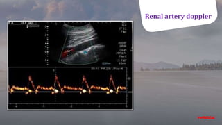 Renal artery doppler
Renal artery doppler
 