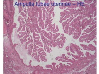 Ampulla tubae uterinae – HE
 