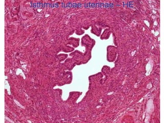 Isthmus tubae uterinae – HE
 