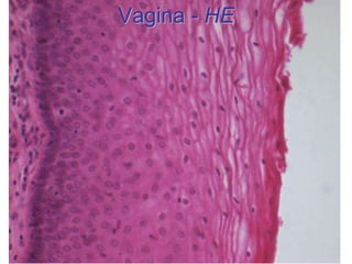 Vagina - HE
 