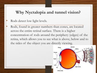 Why Nyctalopia and tunnel vision?
• Rods detect low light levels. 
• Rods, found in greater numbers than cones, are located
across the entire retinal surface. There is a higher
concentration of rods around the periphery (edges) of the
retina, which allows you to see what is above, below and to
the sides of the object you are directly viewing.
 