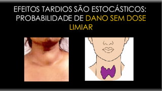 EFEITOS TARDIOS SÃO ESTOCÁSTICOS:  PROBABILIDADE DE  DANO SEM DOSE LIMIAR 